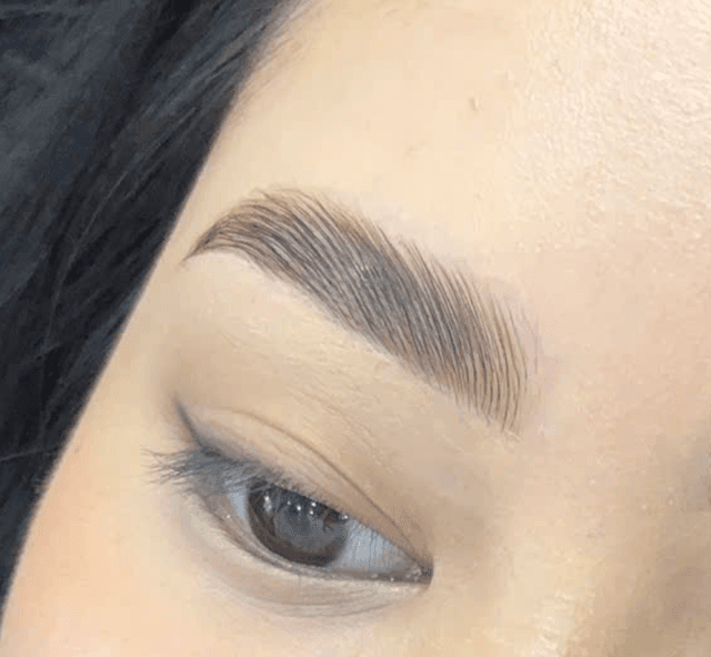Brows Lift